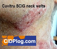 Cuvitru adverse reaction neck lacerations